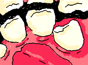 So i gotta get my wisdom tooth taken out T-T