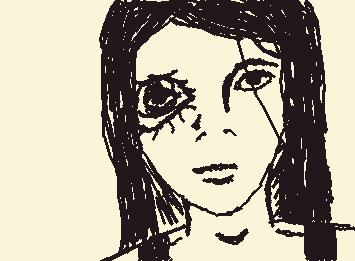 Can u see the other eye?