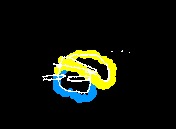 Still in here. IV makes drawing tiring and hard, +laptop is more limited (im on phone rn) ima be back to posting asap :))