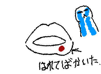 唇バカ痛いと思ったら腫れてた