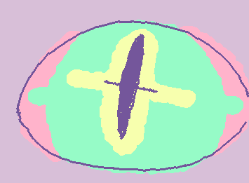 ミテルヨォ