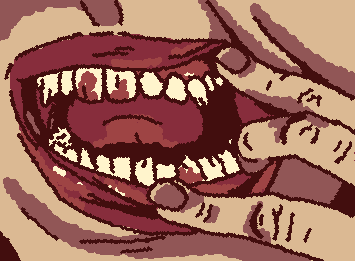 I'm going to the dentist tomorrow -_-   I'm actually quite excited, gonna get my braces off soon!!!