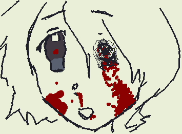 burp