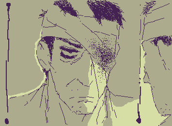 Owie... who ripped ur eye off sir 💔