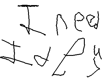 I got out of the hospital 2 hours after the surgery guys! (requests open and very much recomended)