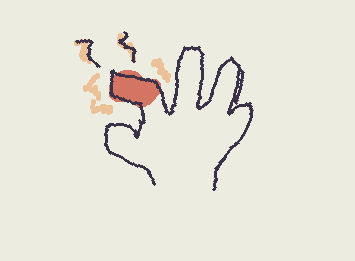 my finger hurts from drawing on a trackpad